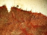 Hoornsteeltaailing onder de microscoop